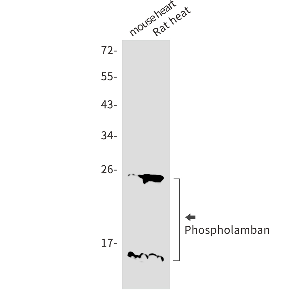 1 - Phospholamban Rabbit mAb AP75907