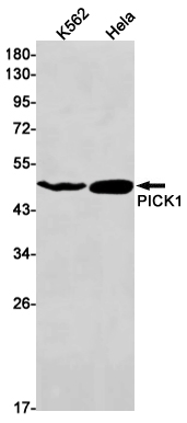 1 - PICK1 Rabbit mAb AP75911