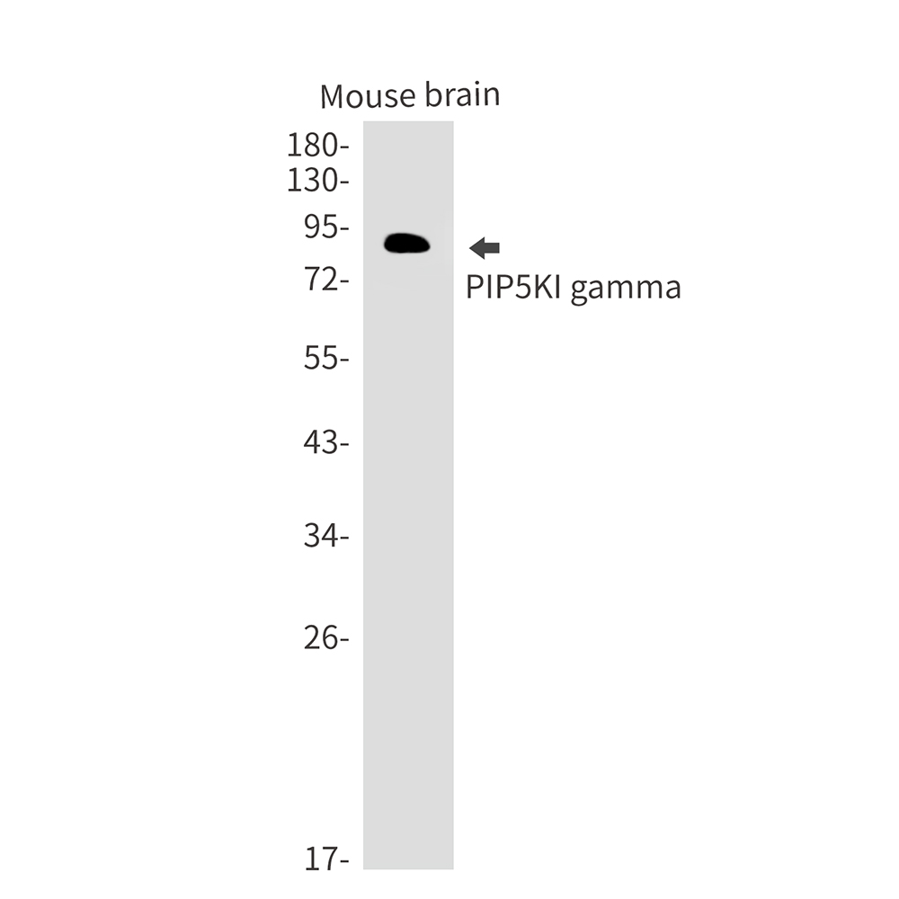 1 - PIP5K1C Rabbit mAb AP75915