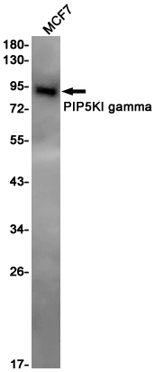 0 - PIP5K1C Rabbit mAb AP75915