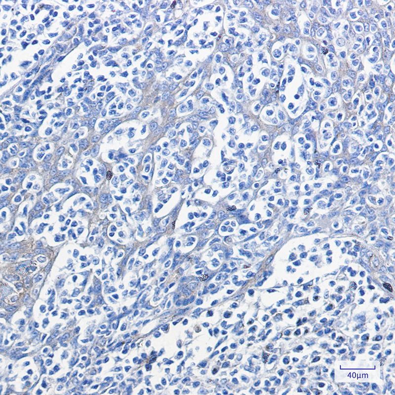 3 - Phospho-PRKAR2A (Ser99) Rabbit mAb AP75916