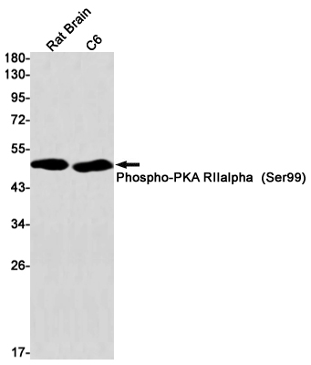 2 - Phospho-PRKAR2A (Ser99) Rabbit mAb AP75916