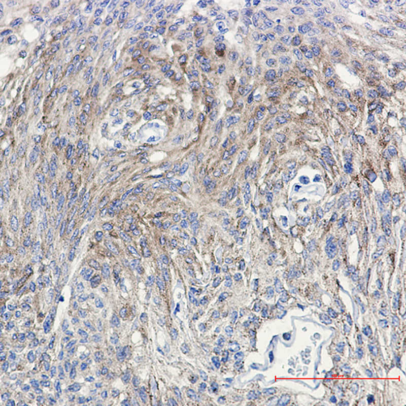 0 - [KD]Phospho-PKC gamma (Thr514) Rabbit mAb AP75917
