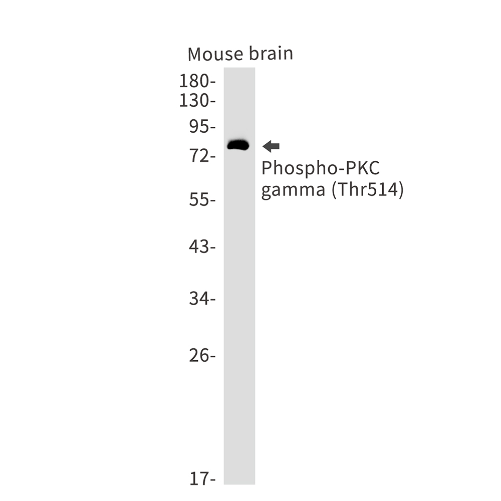 2 - [KD]Phospho-PKC gamma (Thr514) Rabbit mAb AP75917