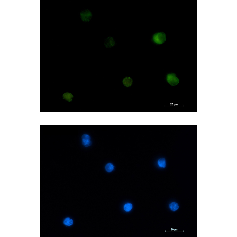 1 - PKC beta 2 Rabbit mAb AP75918