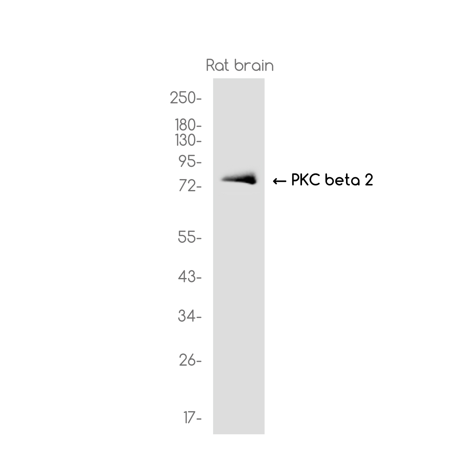 8 - PKC beta 2 Rabbit mAb AP75918