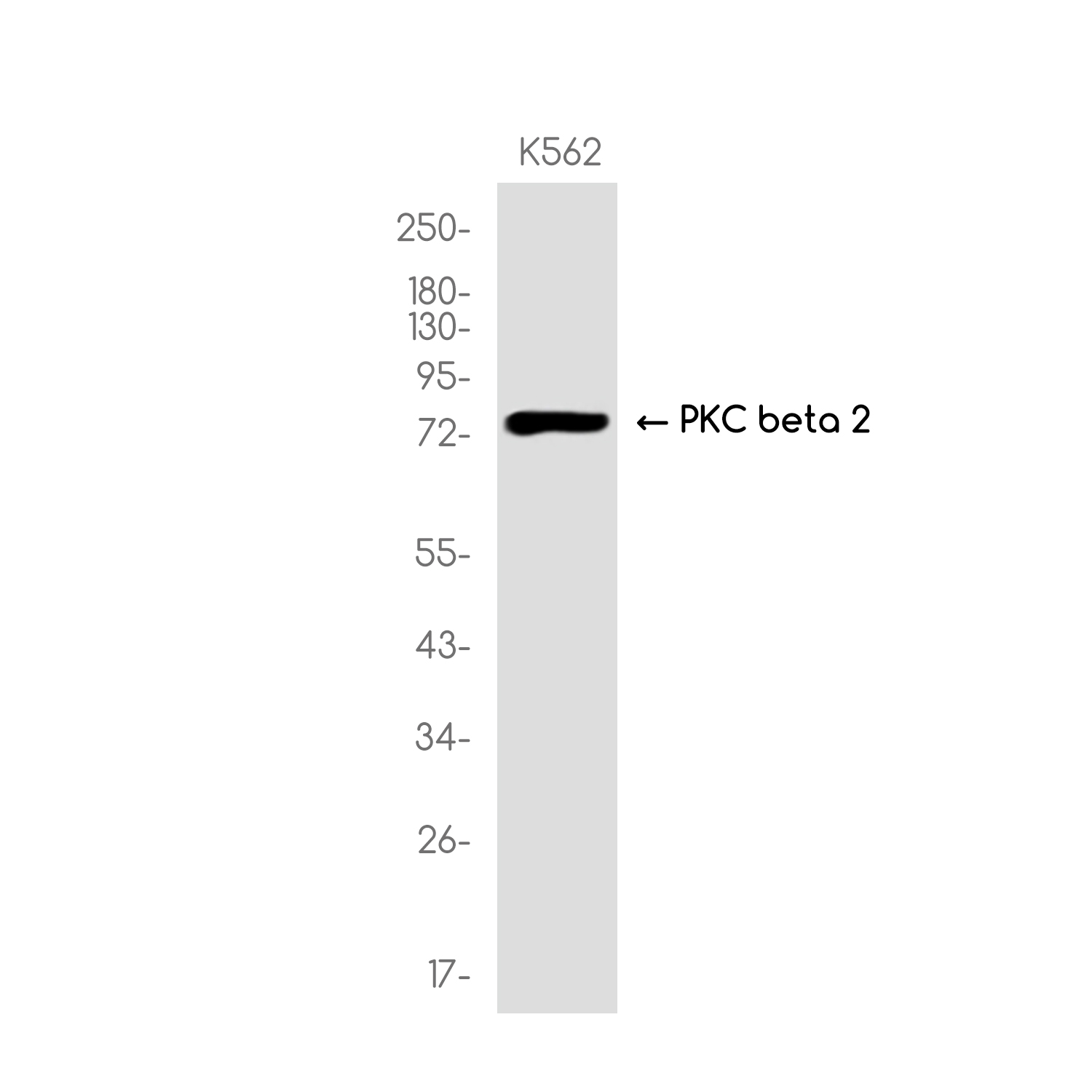 4 - PKC beta 2 Rabbit mAb AP75918