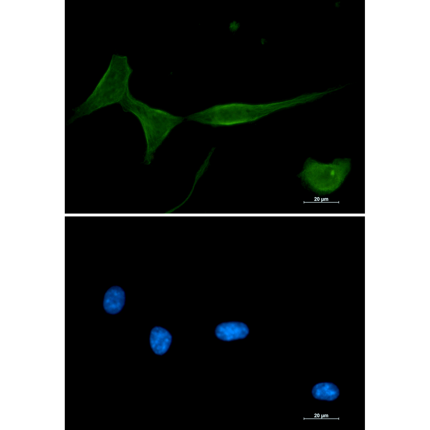 8 - [KD]PKC delta Rabbit mAb AP75919