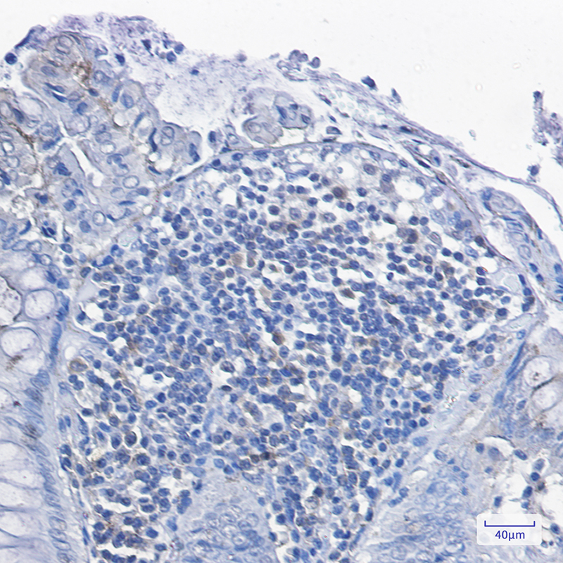 0 - [KD]PKC delta Rabbit mAb AP75919