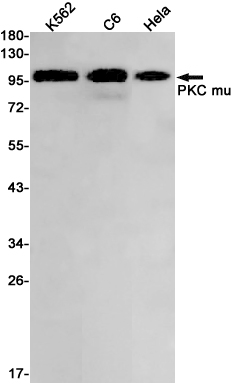 1 - PKC mu/PKD Rabbit mAb AP75921
