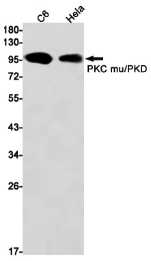 1 - PKC mu/PKD Rabbit mAb AP75922