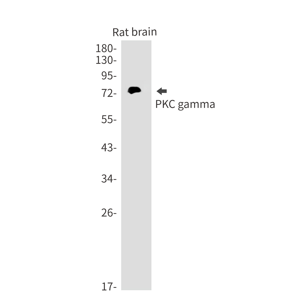 1 - PKC gamma Rabbit mAb AP75923