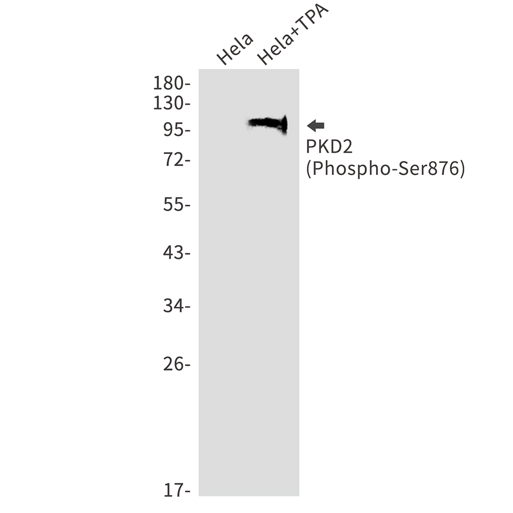 1 - Phospho-PRKD2 (Ser876) Rabbit mAb AP75924