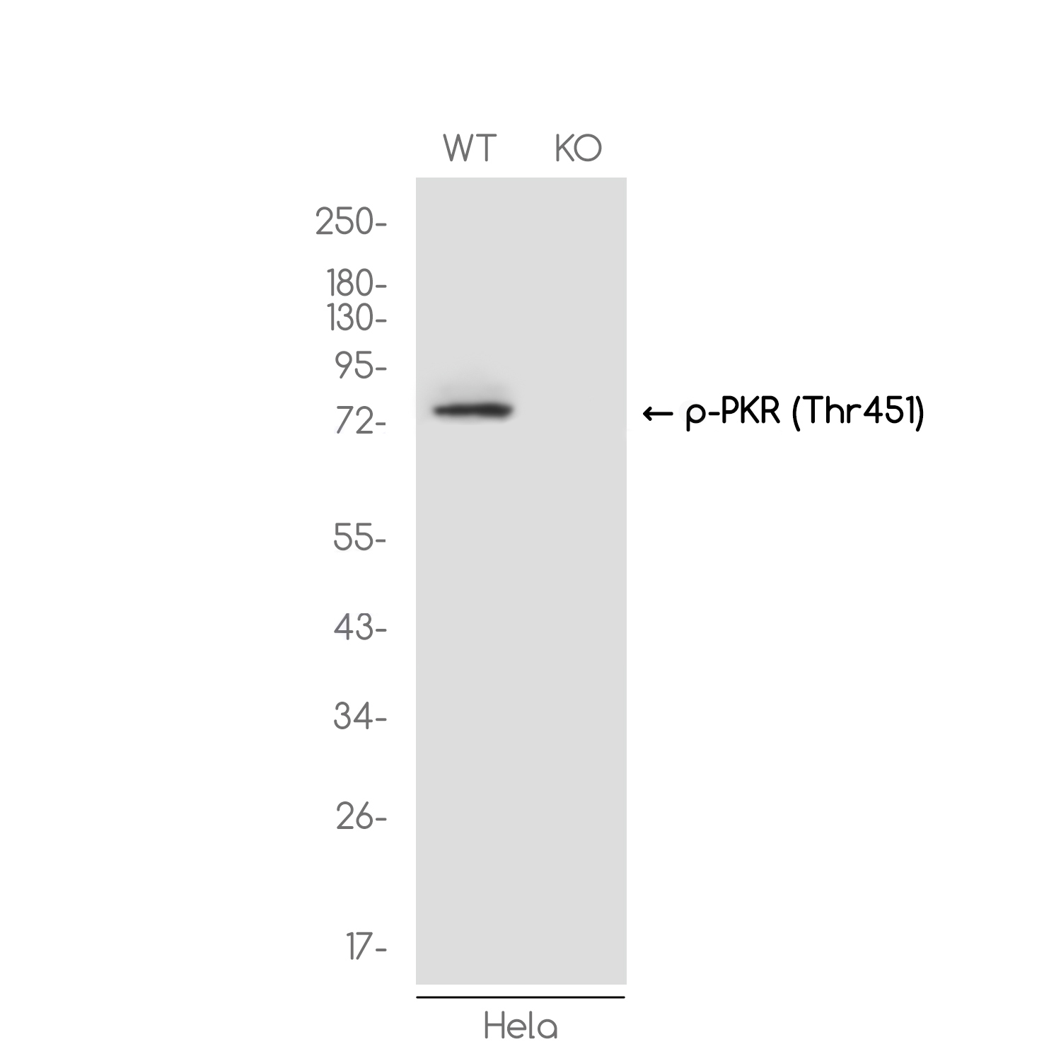 1 - [KO]Phospho-PKR (Thr451) Rabbit mAb AP75926