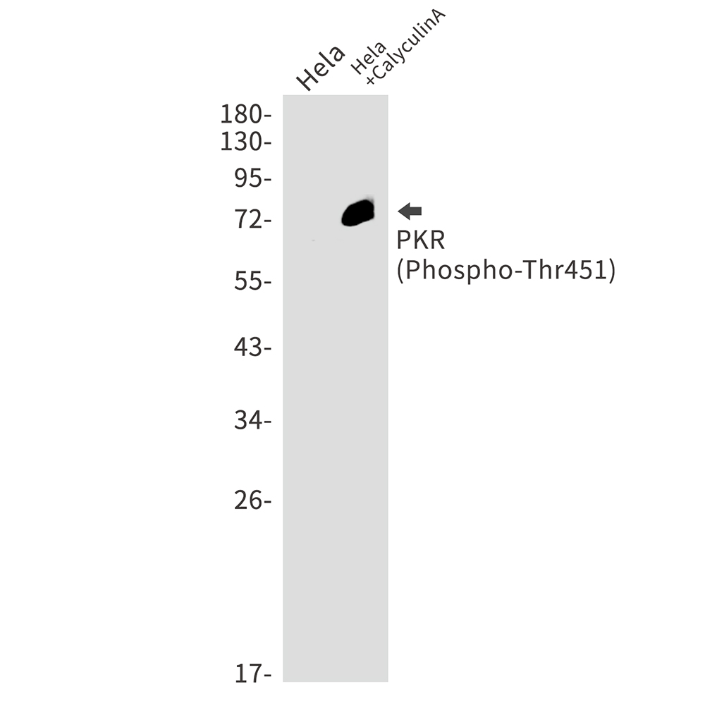 0 - [KO]Phospho-PKR (Thr451) Rabbit mAb AP75926