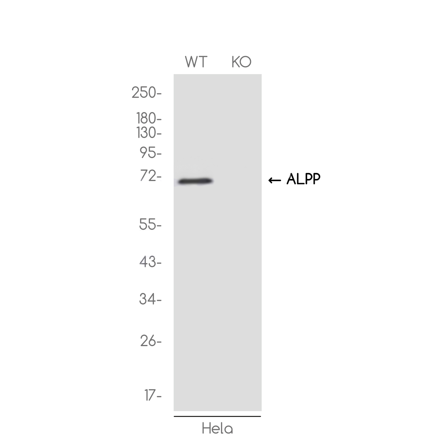 1 - [KO]Placental Alkaline Phosphatase Rabbit mAb AP75927