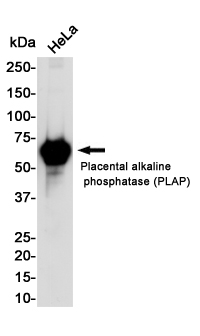2 - [KO]Placental Alkaline Phosphatase Rabbit mAb AP75927