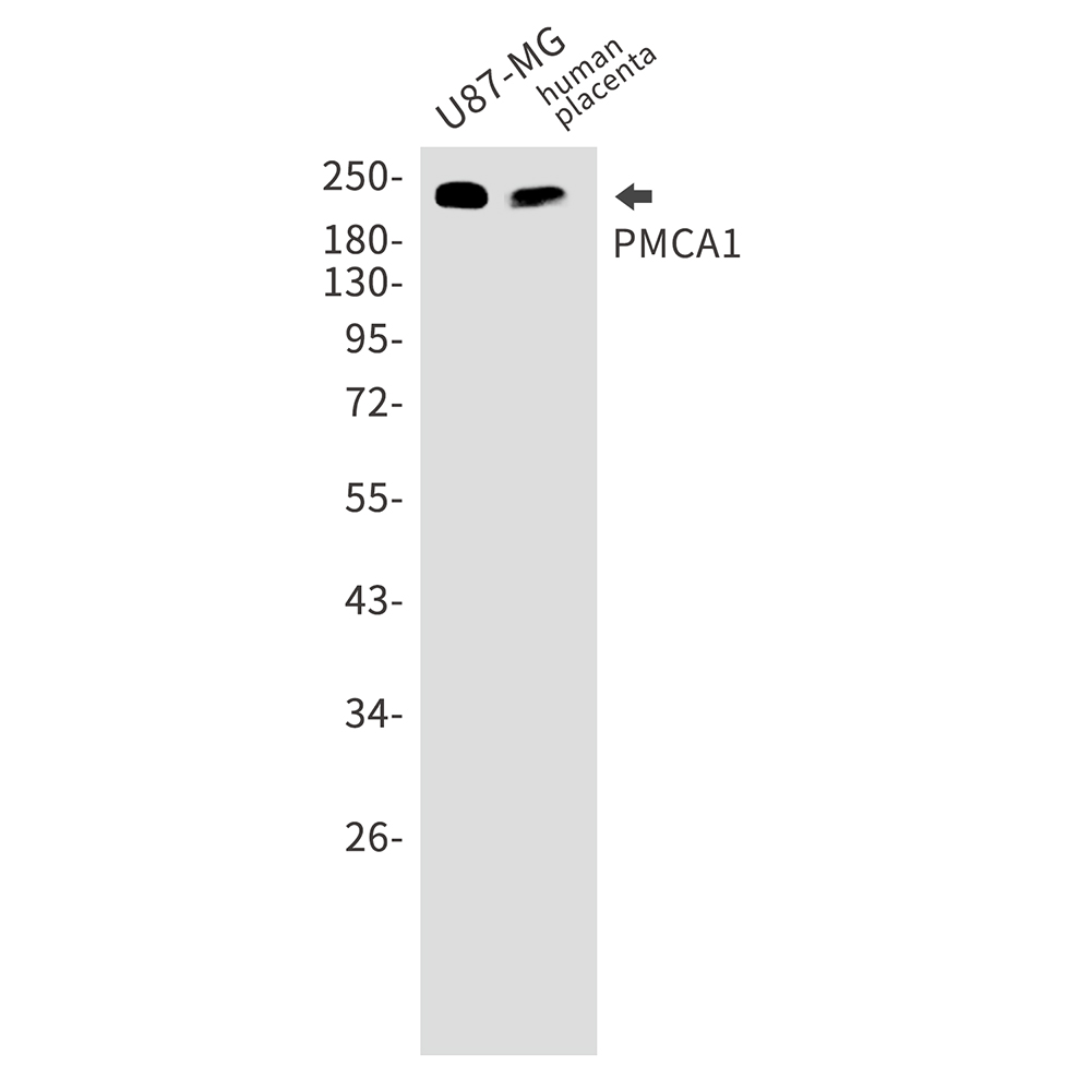 2 - PMCA1 Rabbit mAb AP75929