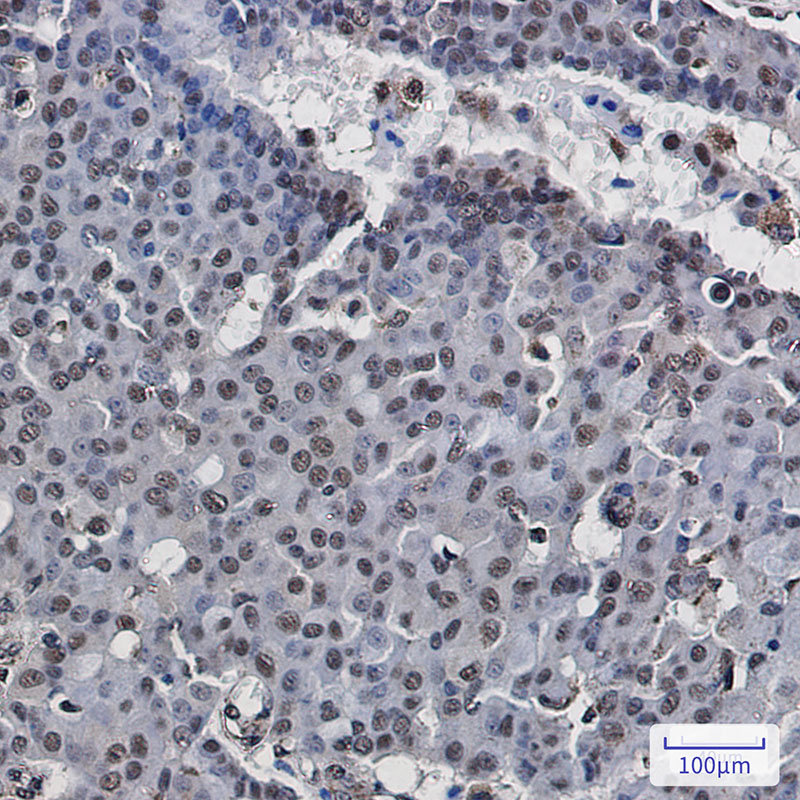 2 - POLR2E/rpb5 Rabbit mAb AP75932
