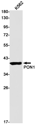 5 - PON1 Rabbit mAb AP75933