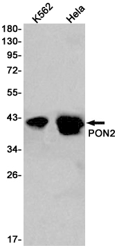 1 - PON2 Rabbit mAb AP75934