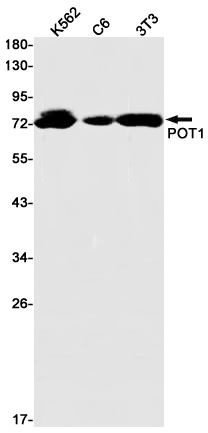 1 - POT1 Rabbit mAb AP75935