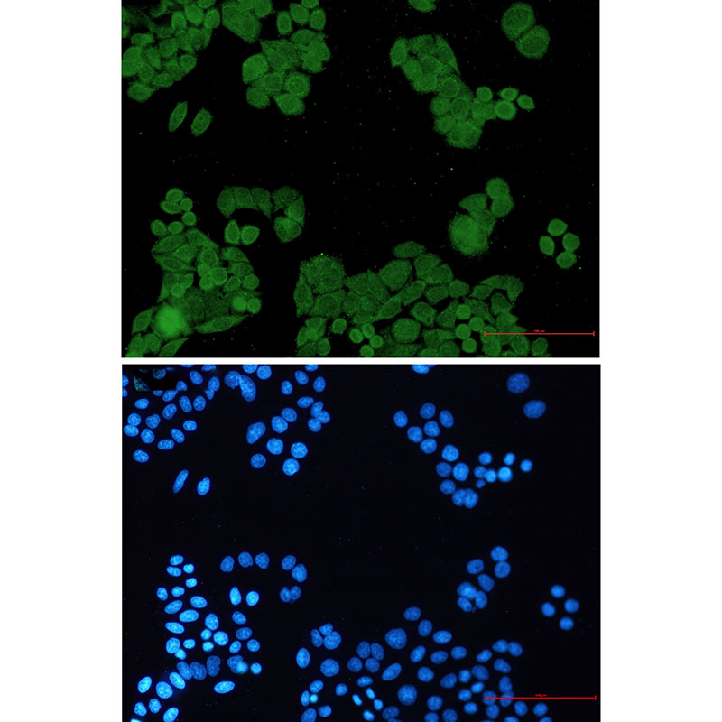 8 - PP2A alpha/beta Rabbit mAb AP75936