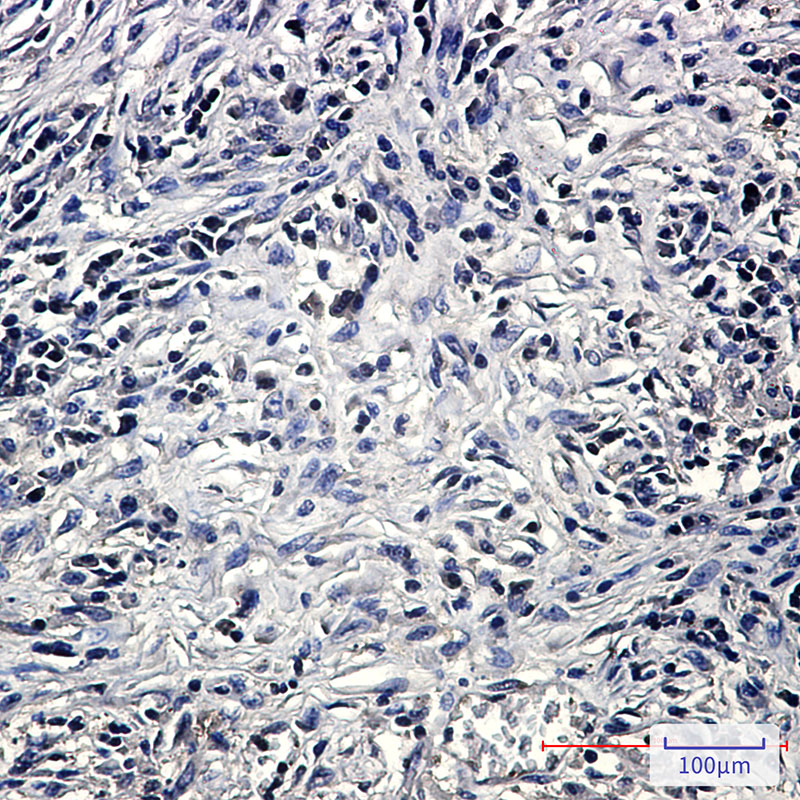 4 - PP2A alpha/beta Rabbit mAb AP75936