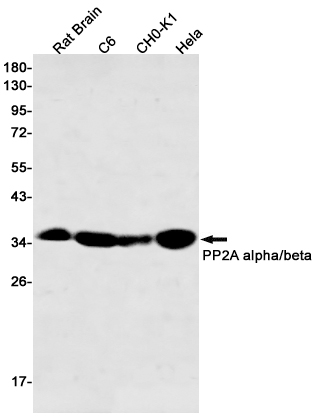 2 - PP2A alpha/beta Rabbit mAb AP75936