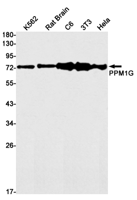 1 - PPM1G Rabbit mAb AP75938