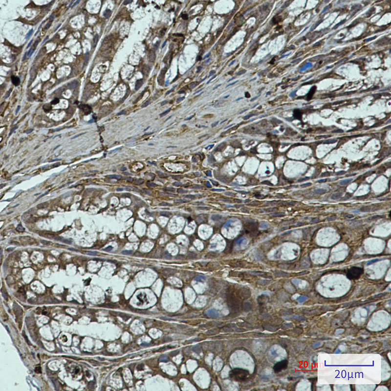 1 - PP1C alpha/beta Rabbit mAb AP75939