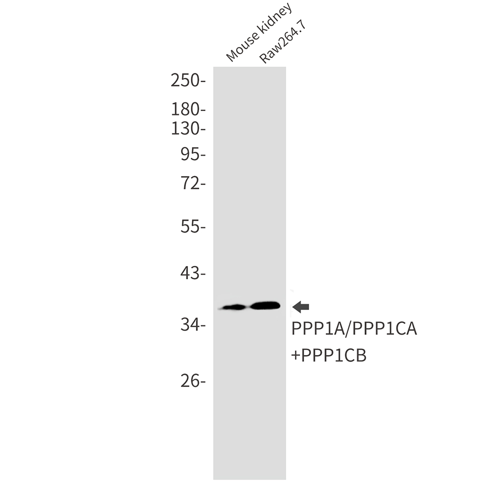2 - PP1C alpha/beta Rabbit mAb AP75939