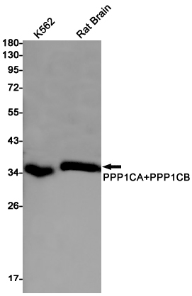 8 - PP1C alpha/beta Rabbit mAb AP75939