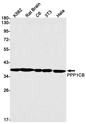 1 - PPP1CB Rabbit mAb AP75940