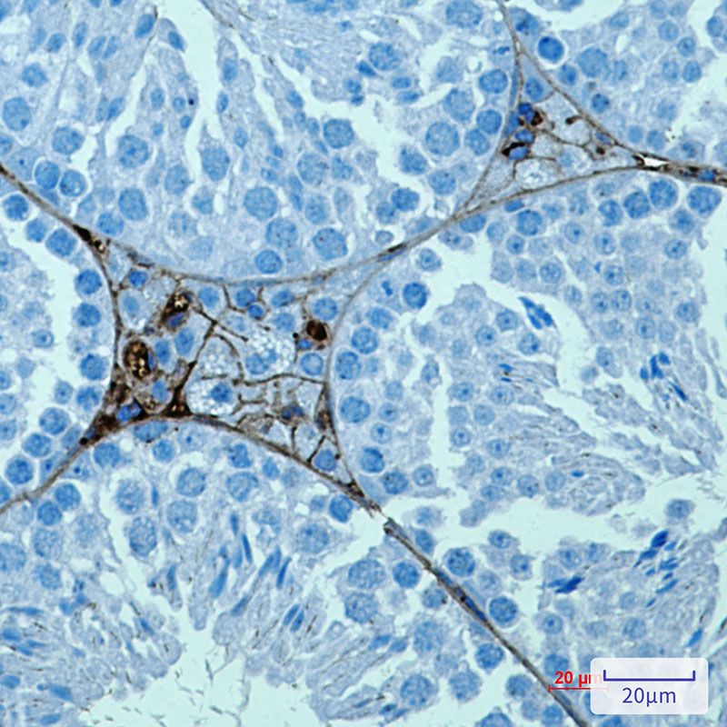 2 - [KO]PRAME Rabbit mAb AP75943