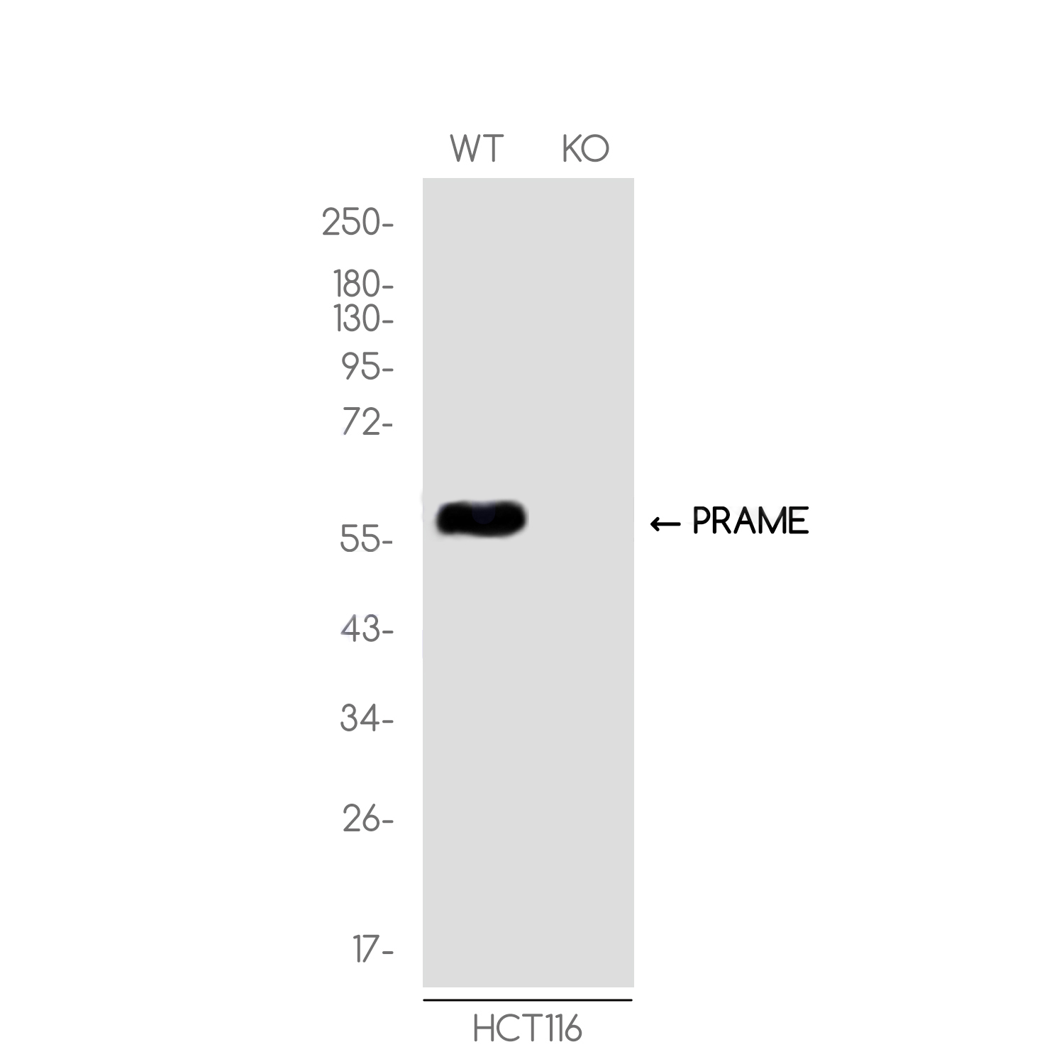 1 - [KO]PRAME Rabbit mAb AP75943