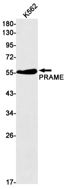 8 - [KO]PRAME Rabbit mAb AP75943