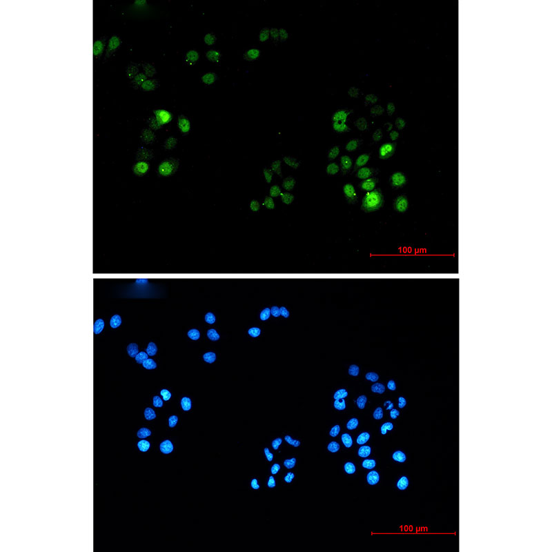 8 - Phospho-PRC1 (Thr481) Rabbit mAb AP75944