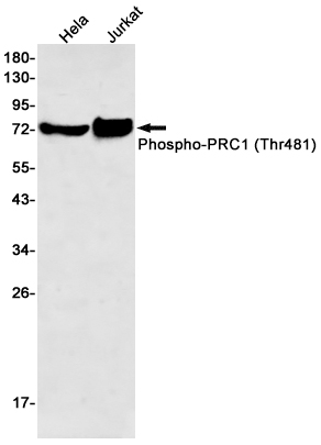 1 - Phospho-PRC1 (Thr481) Rabbit mAb AP75944