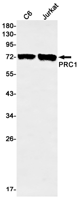 1 - PRC1 Rabbit mAb AP75945