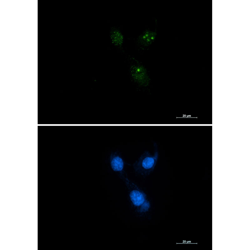 2 - [KD]Presenilin 1 Rabbit mAb AP75948