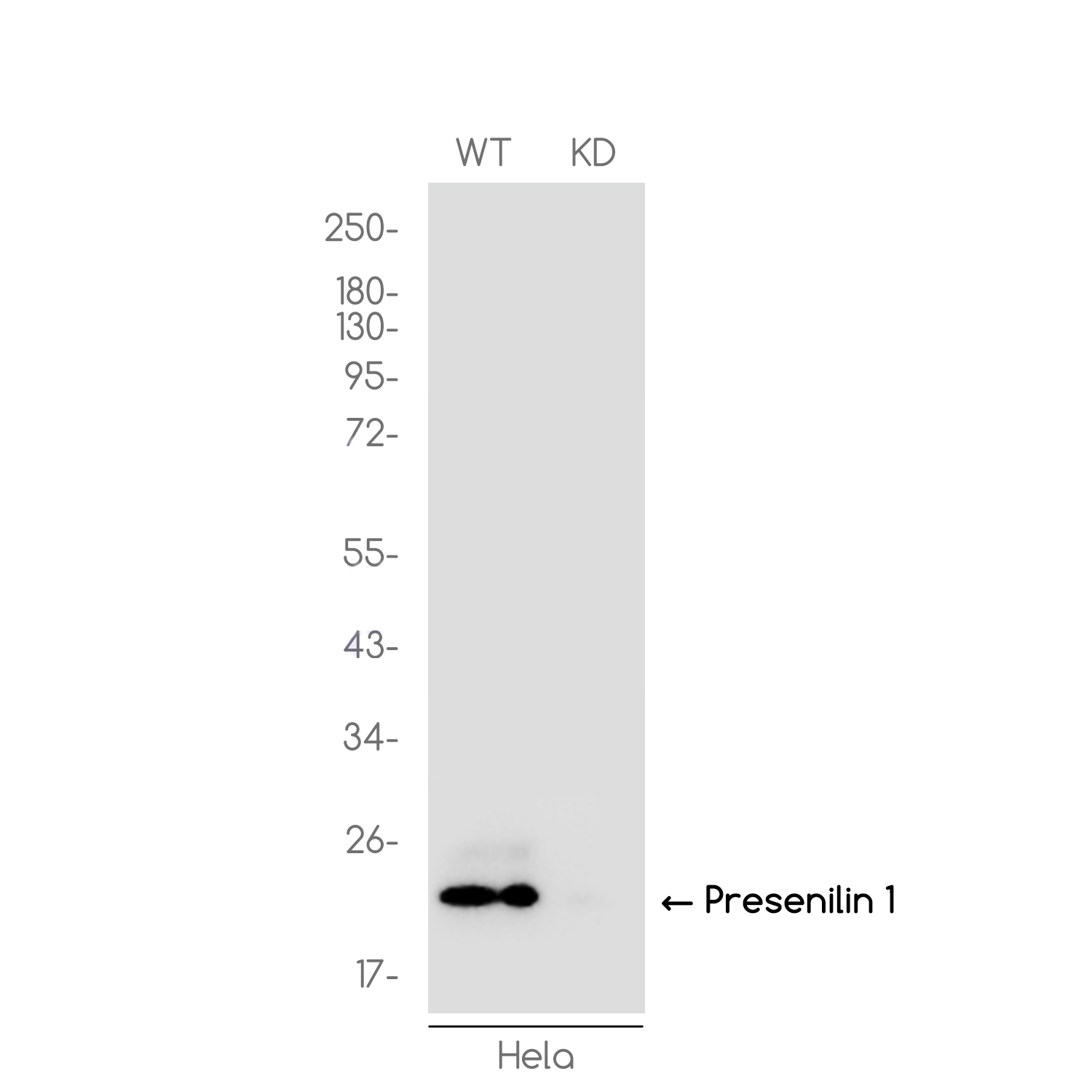 1 - [KD]Presenilin 1 Rabbit mAb AP75948