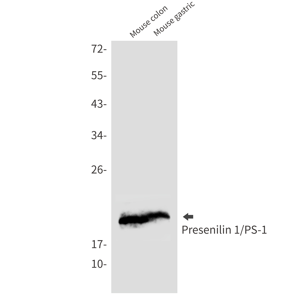 3 - [KD]Presenilin 1 Rabbit mAb AP75948