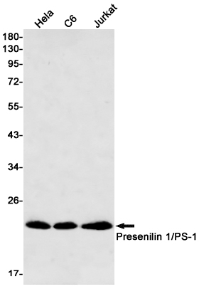 0 - [KD]Presenilin 1 Rabbit mAb AP75948