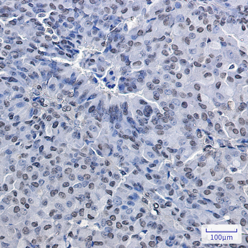 0 - [KO]PRMT1 Rabbit mAb AP75951