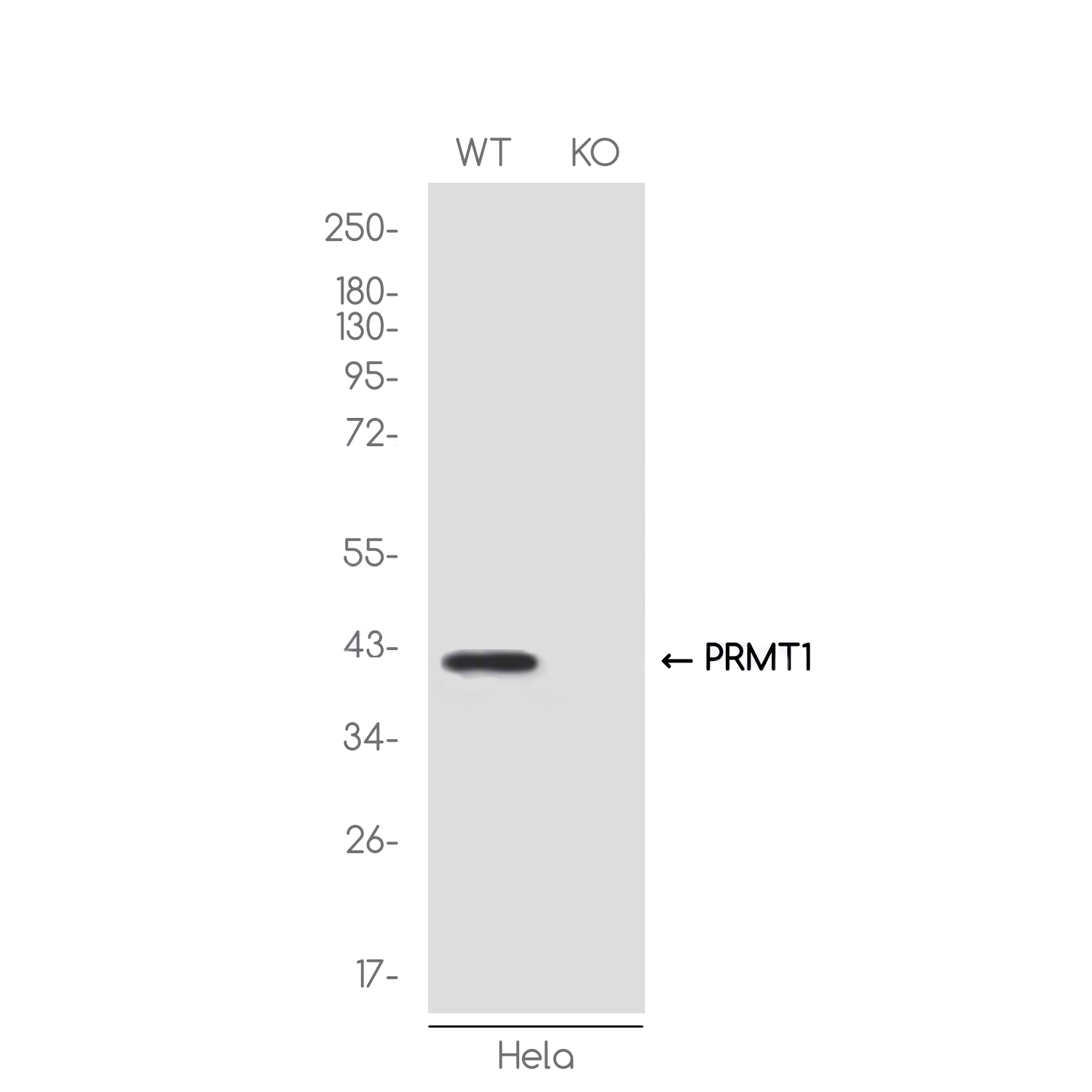 1 - [KO]PRMT1 Rabbit mAb AP75951