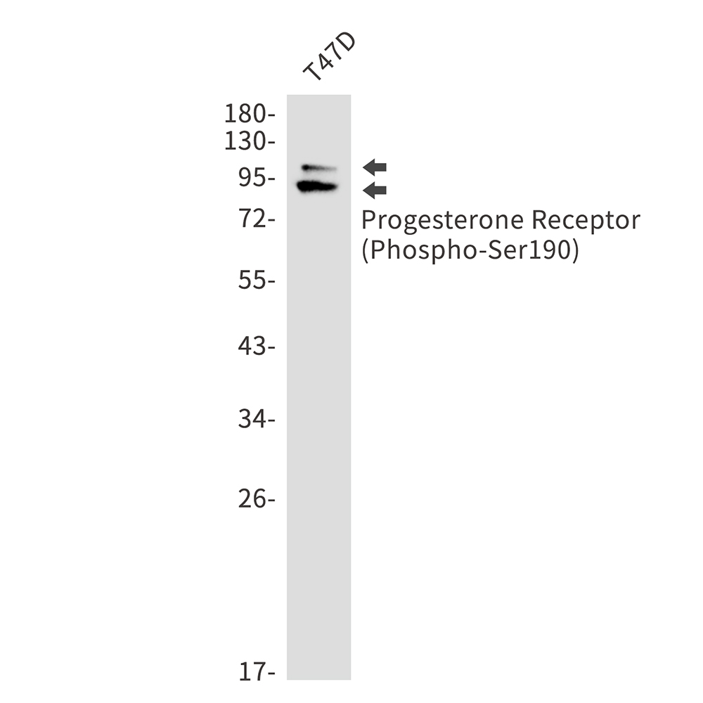 1 - Phospho-Progesterone Receptor (Ser190) Rabbit mAb AP75954