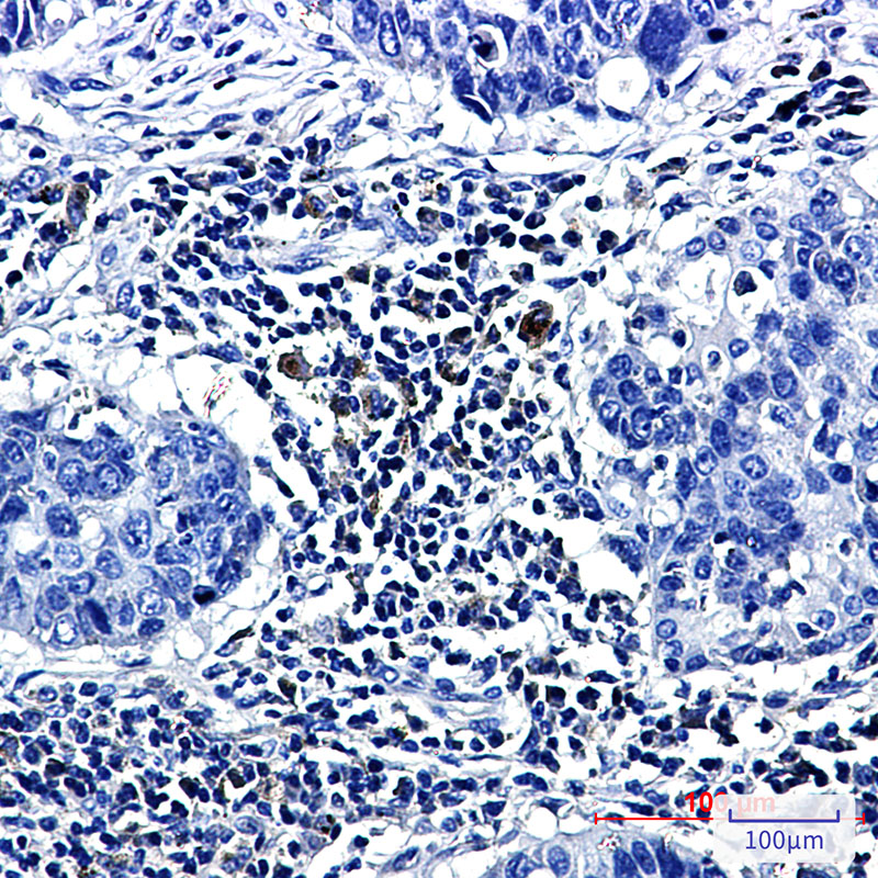 8 - Prostaglandin D Synthase Rabbit mAb AP75955