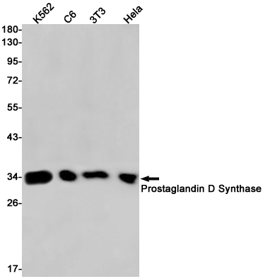 2 - Prostaglandin D Synthase Rabbit mAb AP75955