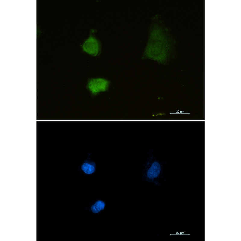 1 - PSMA2 Rabbit mAb AP75957